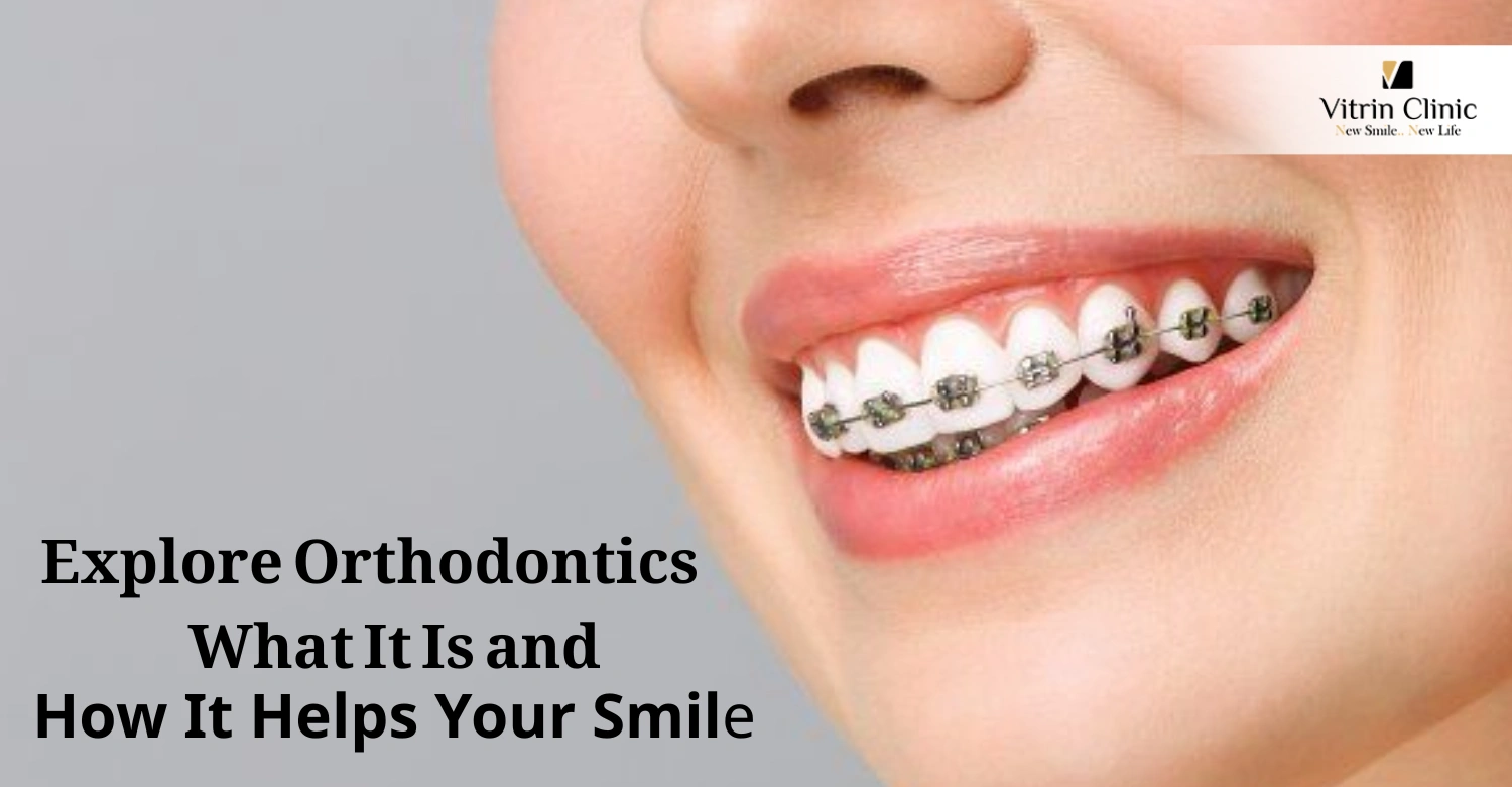 Ortodonti Nedir ve Gülüşünüze Nasıl Katkı Sağlar?